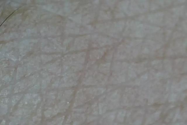 硬刚女皇龙妈也扛不住法令纹,2条沟壑让人心疼,贴一贴就消了