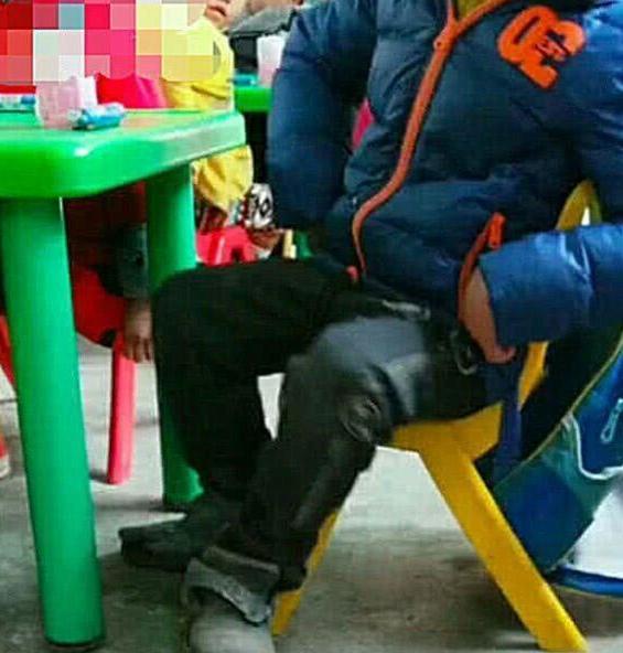 小朋友上课抖腿,孩子上课故意抖动腿怎么回事
