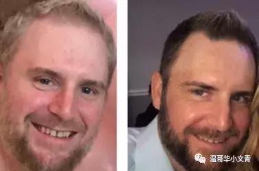 治疗甲状腺癌的十大西药,甲状腺癌有什么药物可治疗