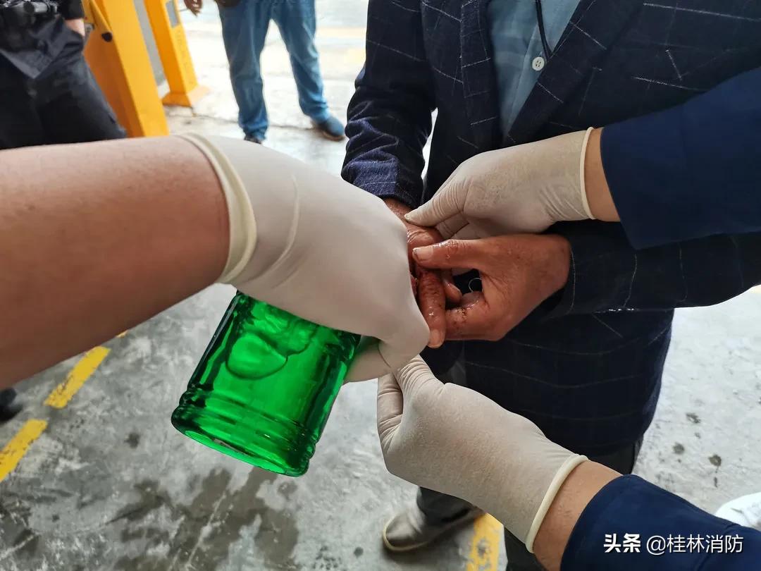 女子戒指卡手手指腐烂,男子戒指卡手消防救援巧脱险