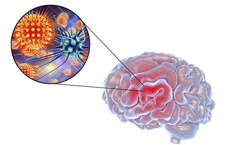 抗炎药和抗生素是一回事吗，如何区分？医生为您讲清楚