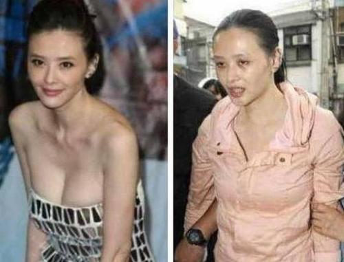 欧美女明星吸毒容貌前后对比,盘点娱乐圈十大吸毒明星