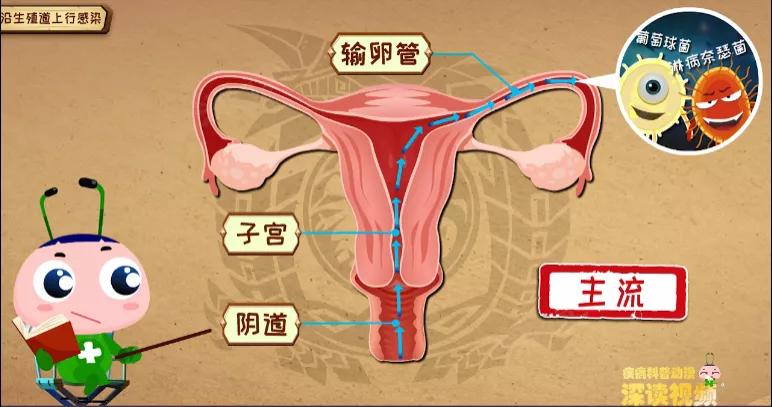 输卵管炎是怎么引起的,输卵管炎症消除动画