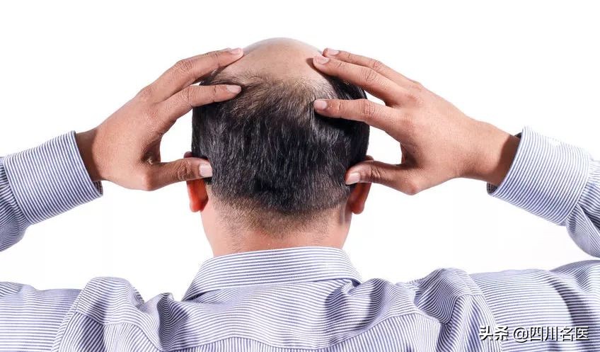 有一种脱发竟然可以不治而愈,冉玉平医生治疗脱发