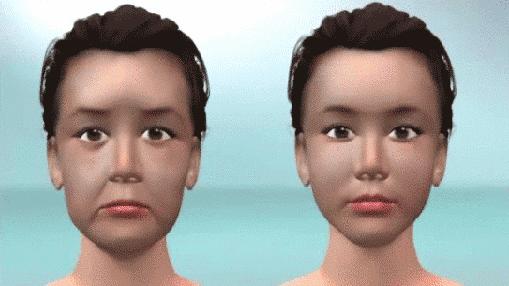 玻尿酸最强科普,最全玻尿酸科普