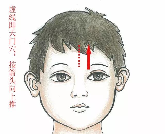 小儿积食发烧如何推拿,小儿推拿按摩积食发烧