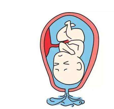 肚子不痛但是拉水便,肚子不痛就发硬怎么回事