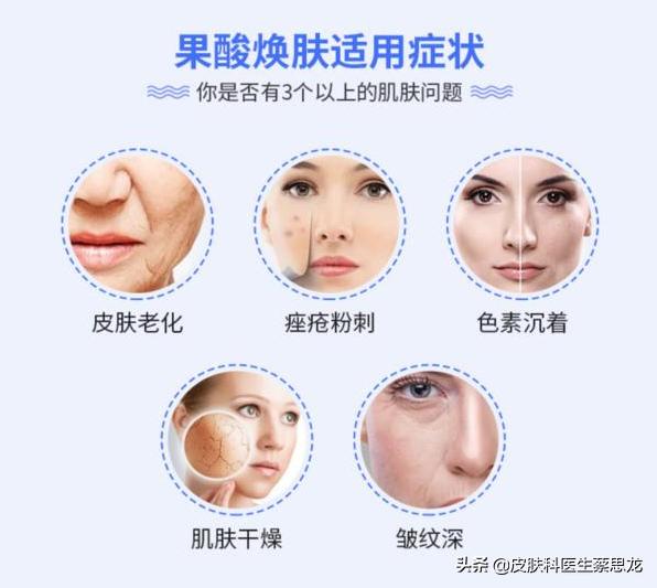 深度剖析换肤果酸刷酸到底是什么,果酸换肤的注意事项和详细步骤