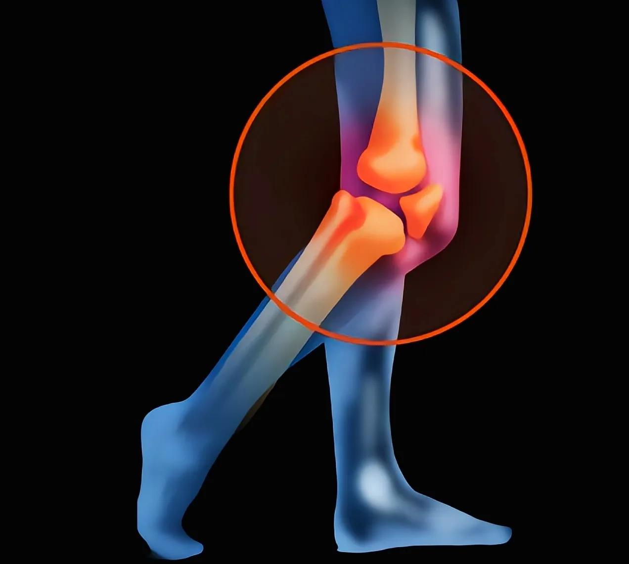 膝关节运动损伤的预防和康复方法,怎样保护膝关节软骨不受损伤
