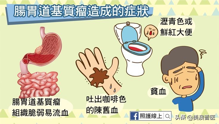 间质瘤导致消化道出血,肠道肿瘤导致出血