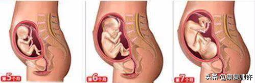 产后腹直肌分离恢复瘦肚子训练,产后腹直肌分离恢复的最佳方法