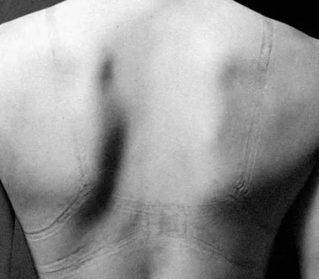 不能抓得太紧会适得其反,皮筋太紧勒手红印子