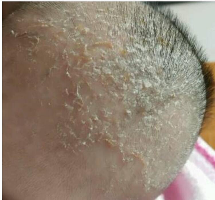 为什么新生儿的头上有污垢？如何正确去头垢？这4个方法要学会