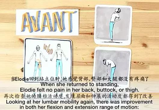 麦肯基，世界公认治疗腰痛的经典方法