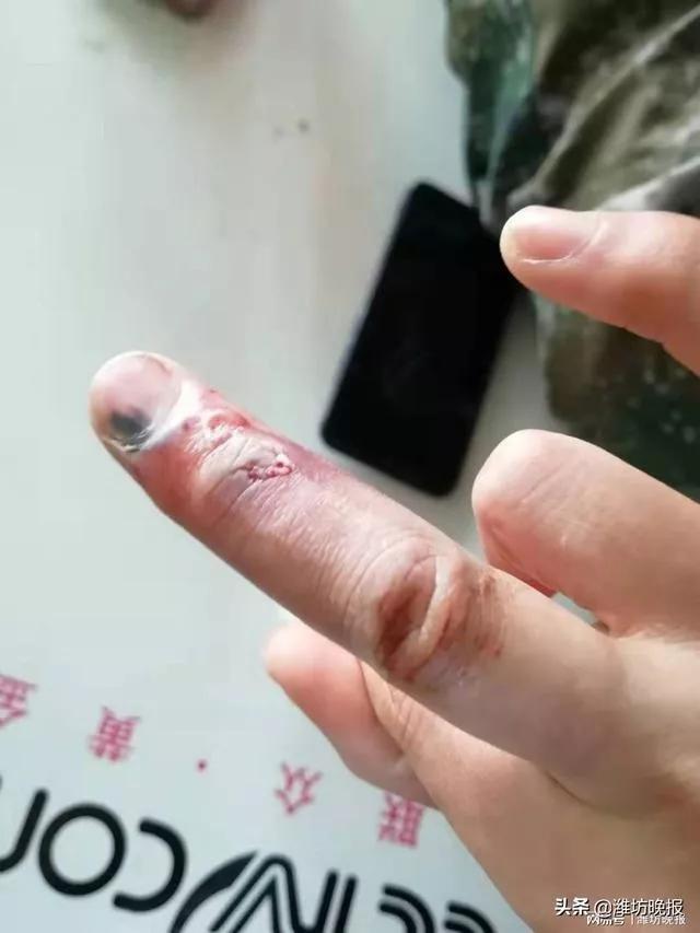 因为疫情你快撑不住了吗,疫情时期你熬住了吗