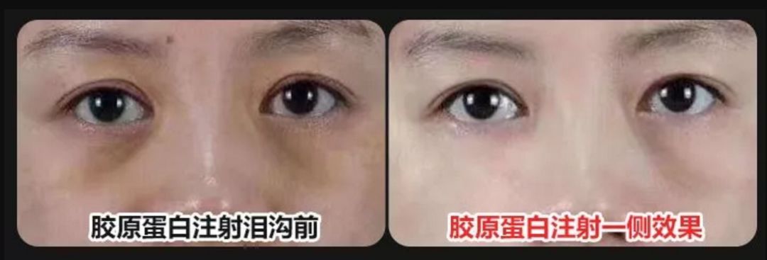 鏈変簡婊ら暅鍐嶅ぇ鐨勭溂琚嬮兘涓嶆槸浜嬪効,鍏眰婊ら暅