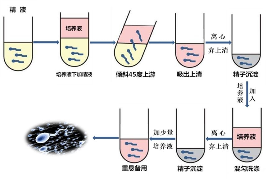 看呆医生:一次成功!医院人工授精太贵,英女子购买针筒自行操作