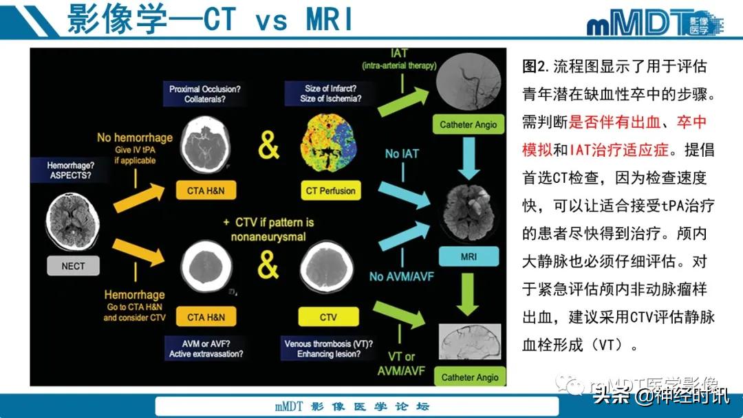 急性缺血性脑卒中ppt素材图片,青年缺血性脑卒中ppt