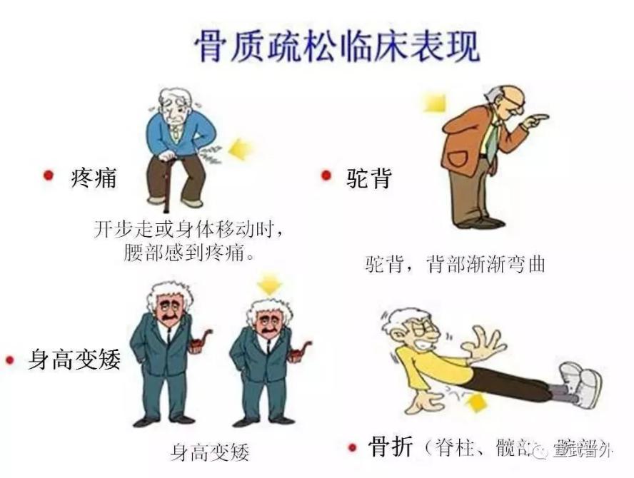 老年人驼背变矮怎么办,老年人驼背是骨质软化症吗