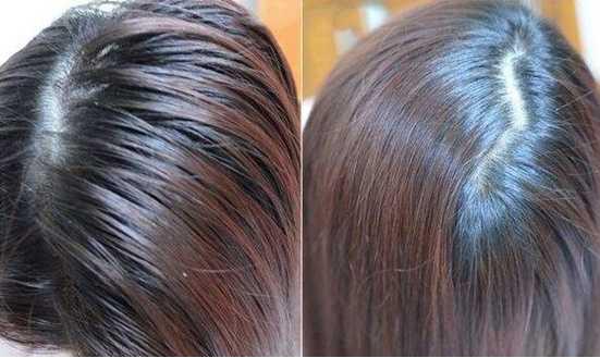 净屑洗发水和去屑洗发水哪个好,国产洗发水和进口洗发水哪个好用