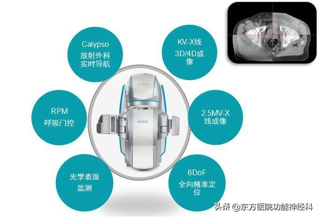 速锋刀,EDGE治疗脑部肿瘤，机器人辅助精准放疗效果佳