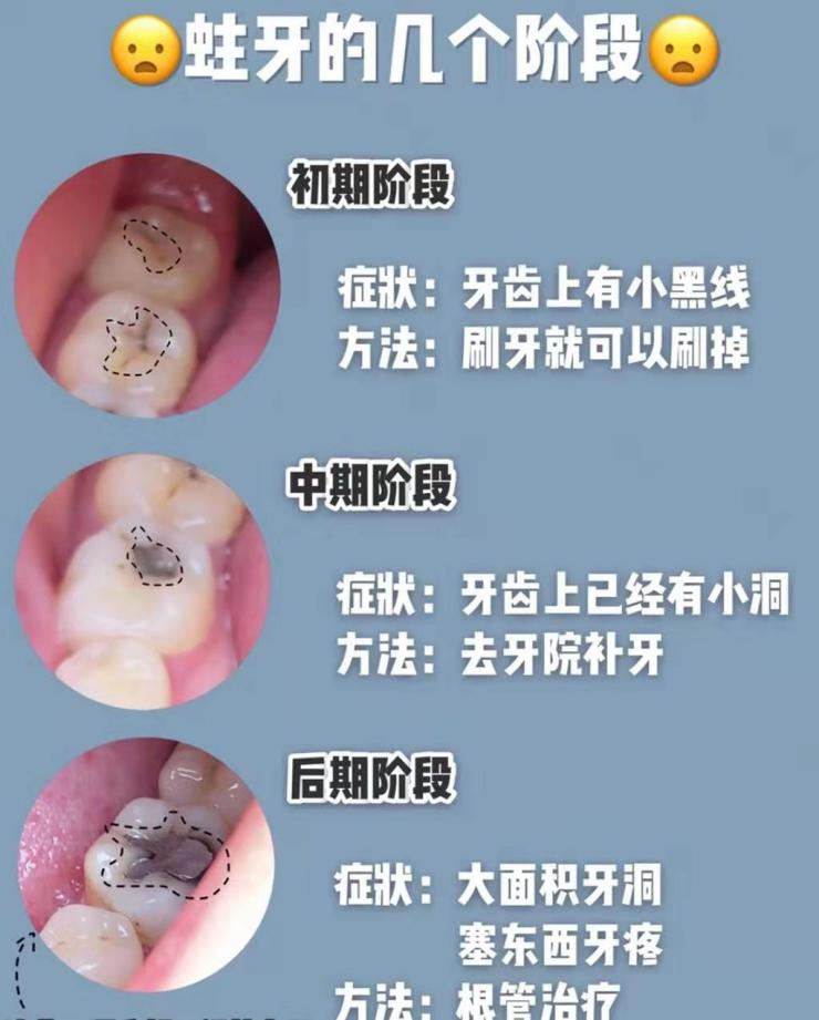 牙齿总是酸痛怎么解决,牙齿总是酸痛是什么原因造成的