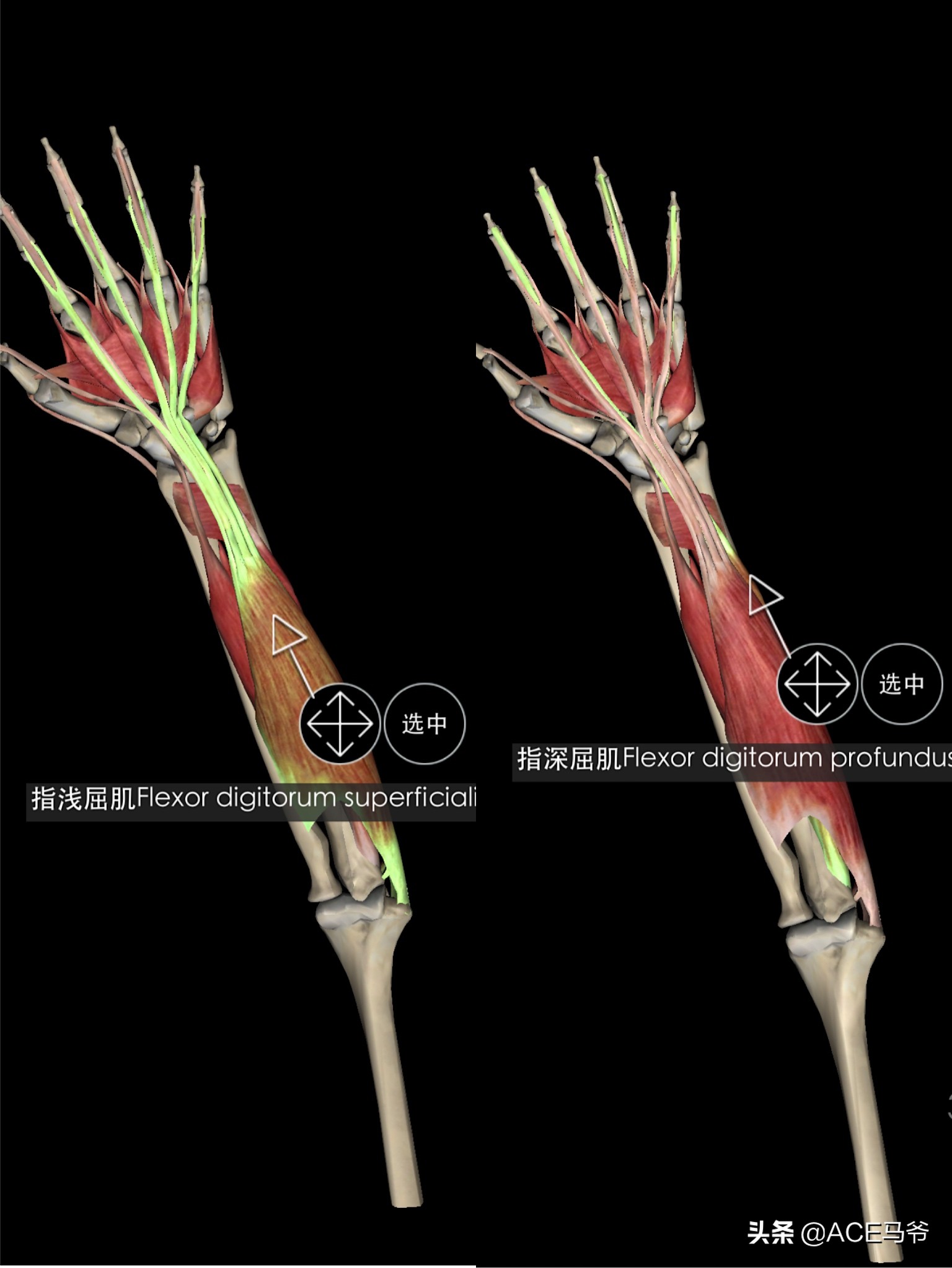 最容易被忽视，但是又非常重要的训练。小臂力量训练