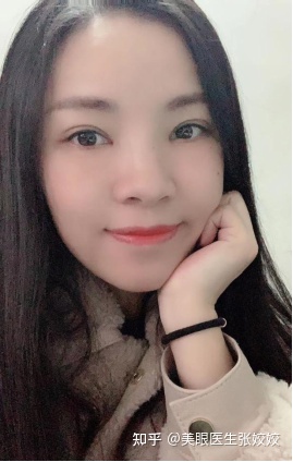 割双眼皮会影响运势吗,40岁割双眼皮效果图