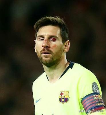 梅西孤独的王者,梅西孤独