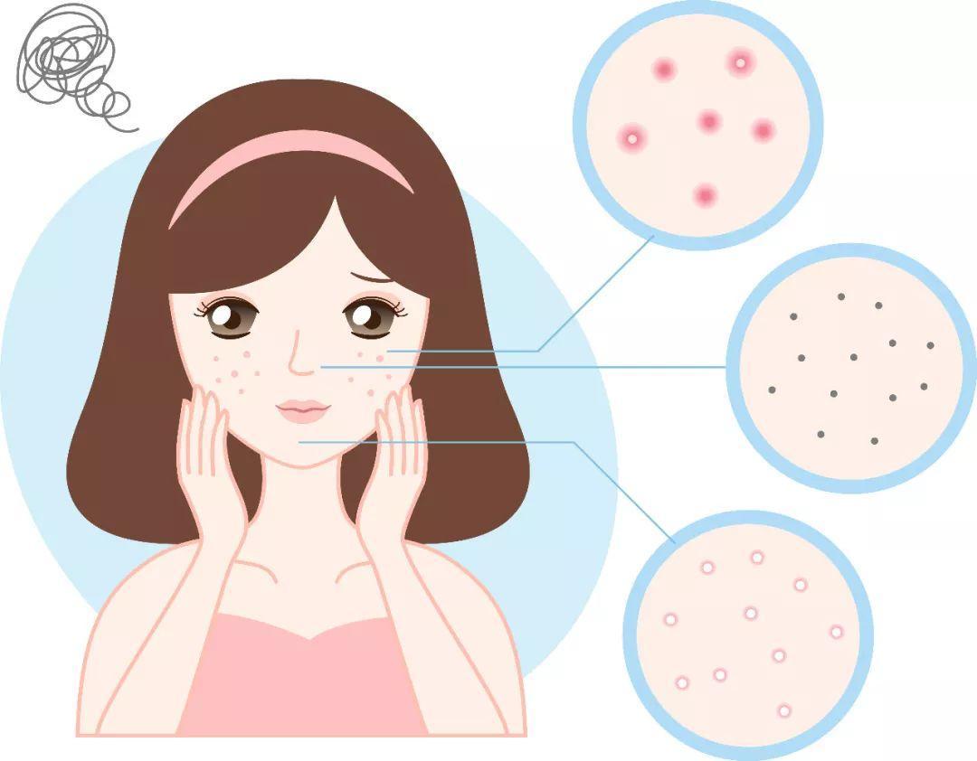 小米有品击破行业暴利！99元搅局万亿市场，宙斯松下：不香了