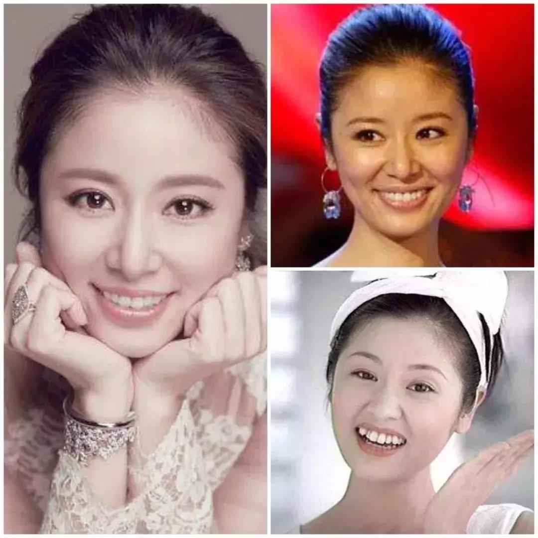 岛国人民竟然流行“八重齿”！*牙虎**真的可爱吗？