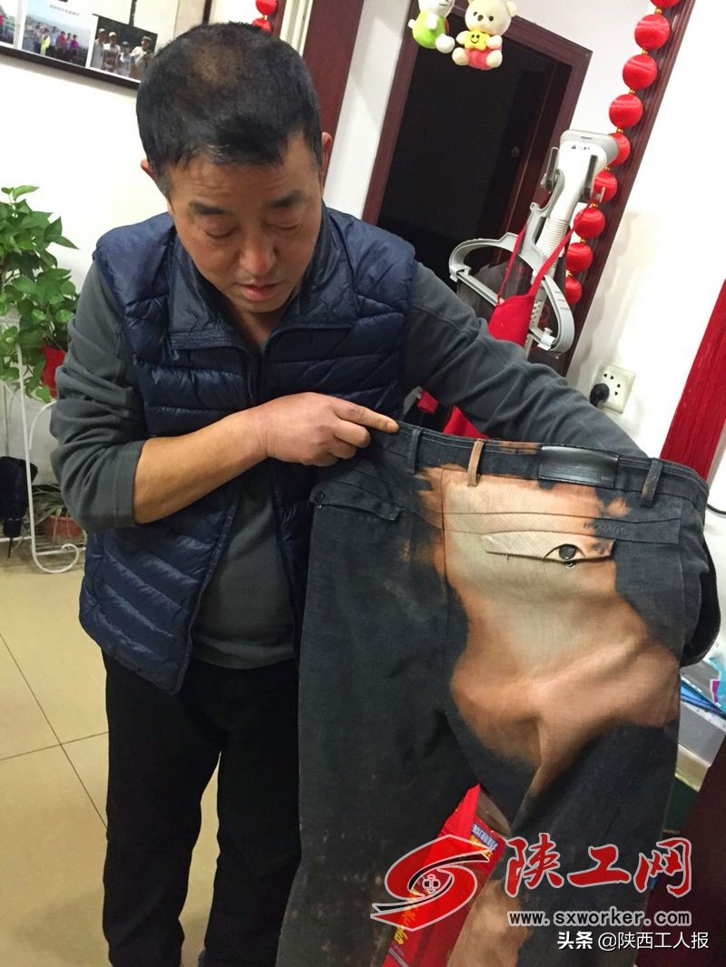 伤口没拆线就让去上班,伤口结痂可以上班吗