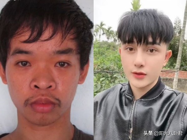 丑男整容变帅哥前后对比,丑男整容变帅哥对比照
