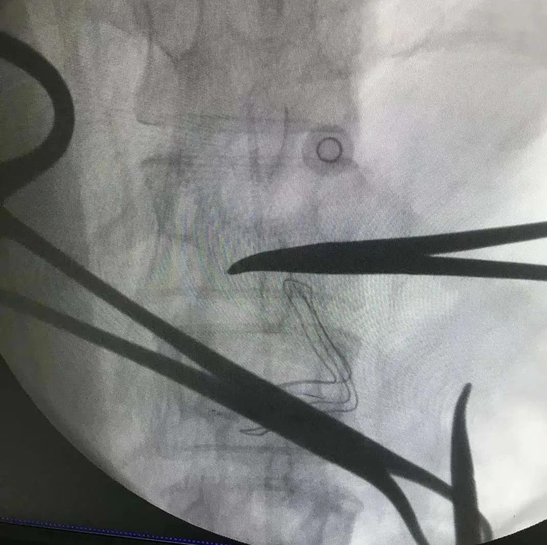 他们痛得想要自杀：被忽视的癌痛|癌痛不用药也能控制！