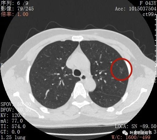 从活检怎么看是非小细胞癌,从病例谈辨证论治