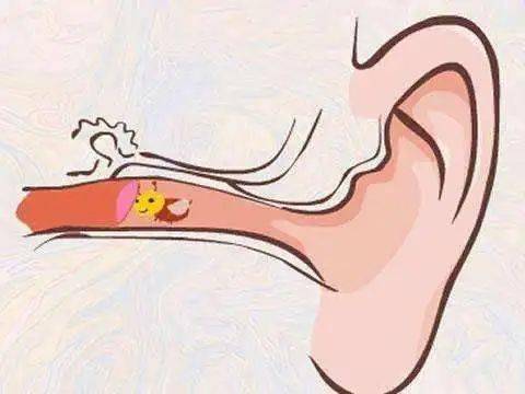 8岁男童在家睡觉耳朵钻进活蟑螂,男童睡觉耳朵钻进活蟑螂全过程