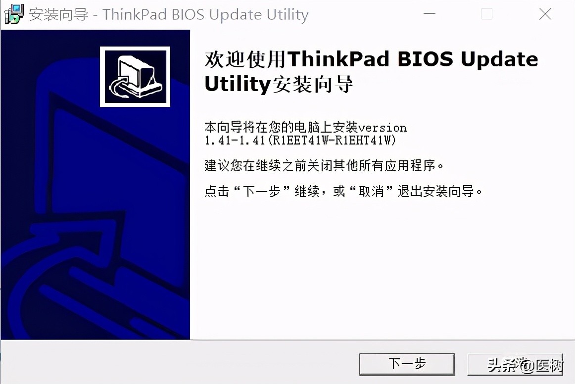 thinkpade15使用技巧,thinkpade15有线连接