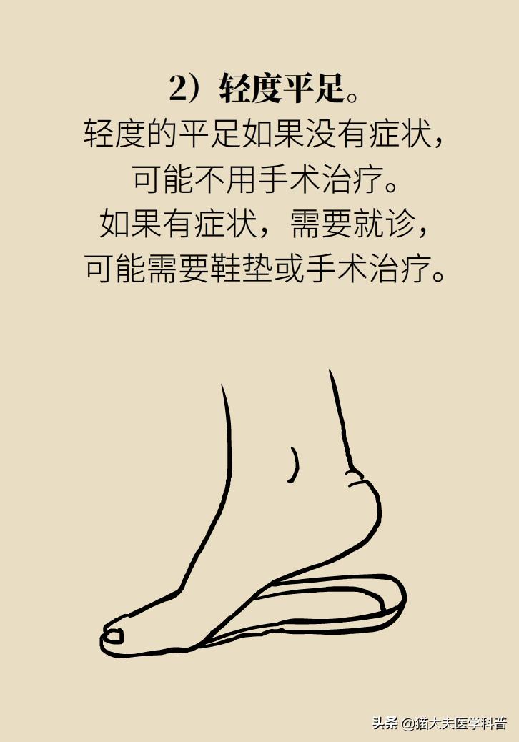 走几百米就痛得不行，这样的平脚板怎么治？