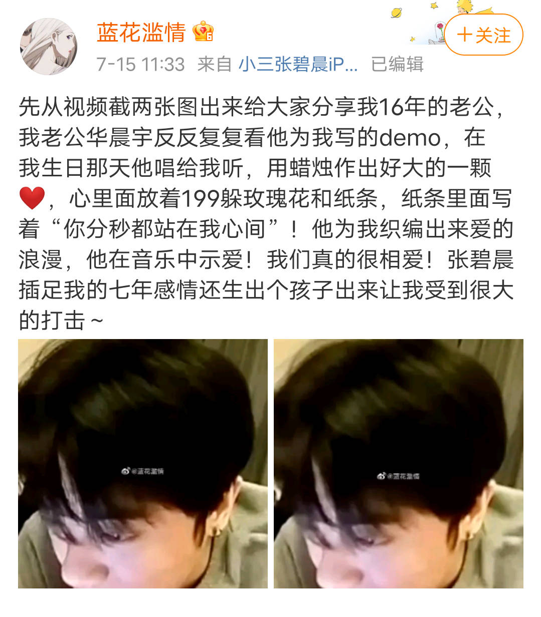 华晨宇是不是植发了,华晨宇是不是植发过