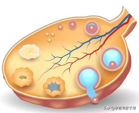 于萍谈多囊排卵,于萍讲多囊卵巢综合征