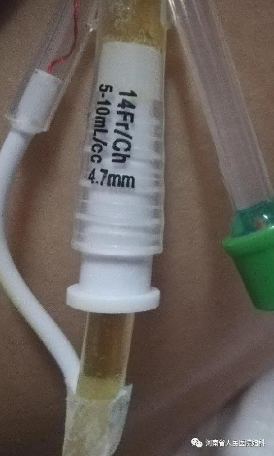 在河南省人民医院妇科一的日子