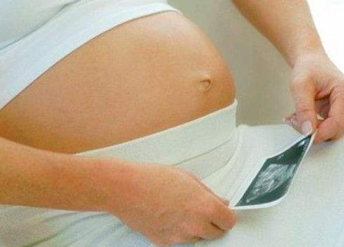 产检b超单上有个x,产检b超单医生都收回去吗