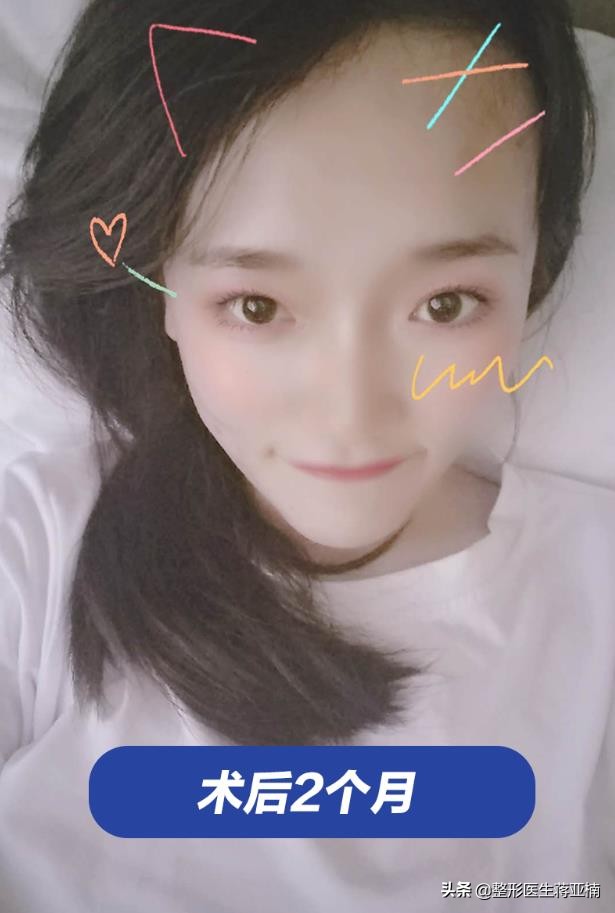 青春不留痘祛痘效果好吗,青春不长痘