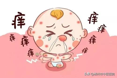 春天花粉过敏的人尽量避免什么,花粉引起脸上过敏怎么办