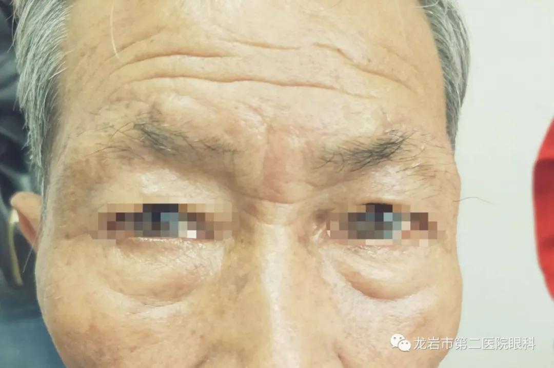 龙岩二院眼科预约电话,龙岩二院眼科在东院吗