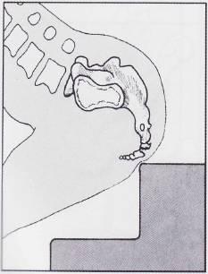 骑自行车尾巴骨疼痛是什么原因,少年尾巴骨疼痛是什么原因