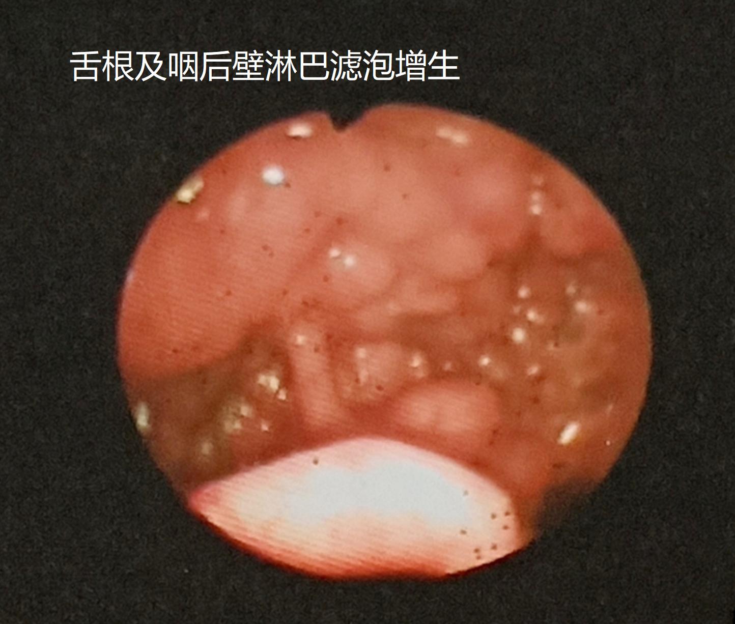 超强度工作，90后销售员“失声”了！保护嗓子有技巧，学了用得上