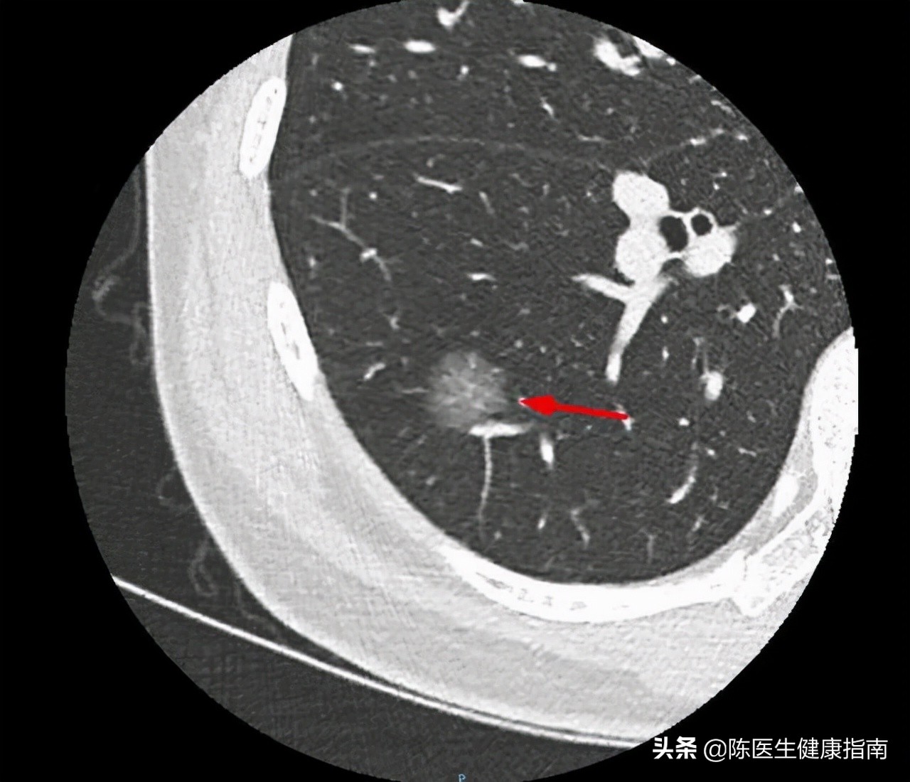一级致癌物石棉瓦的危害有多大,一级致癌物质石棉长什么样