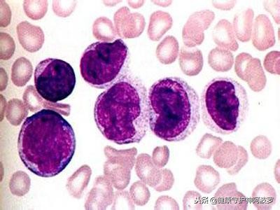格列卫国产药和进口药区别,国产格列卫进入医保价格