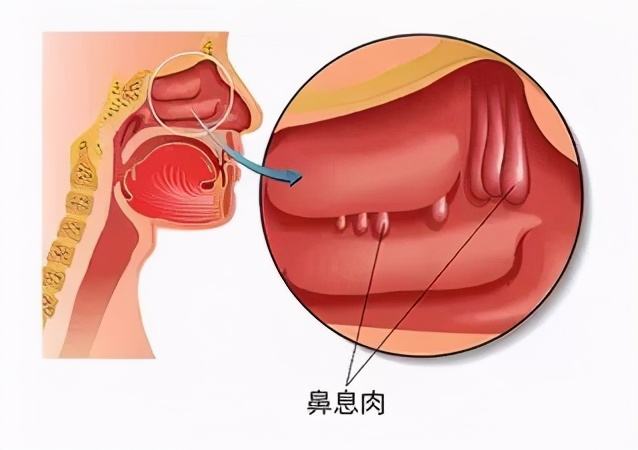 太危险男子独自爬野山被困悬崖,太惊险国外男子因安全帽躲过一劫